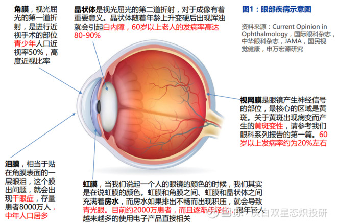 眼科医学成资本市场明星公司“集中营”,三家优质上市公司毛利率就没有低于40%