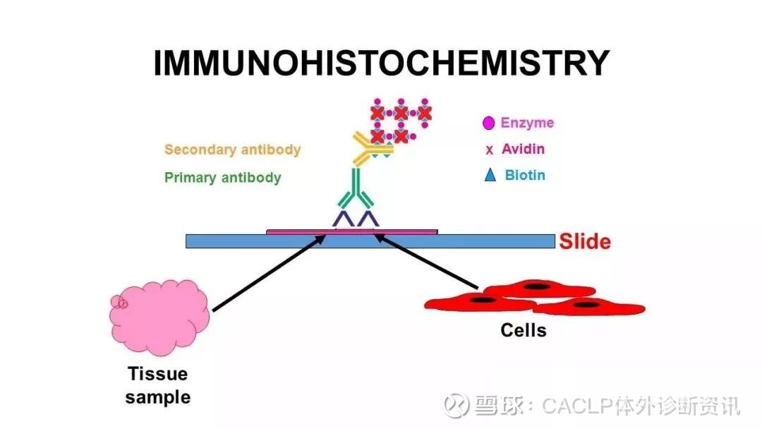 Ihc