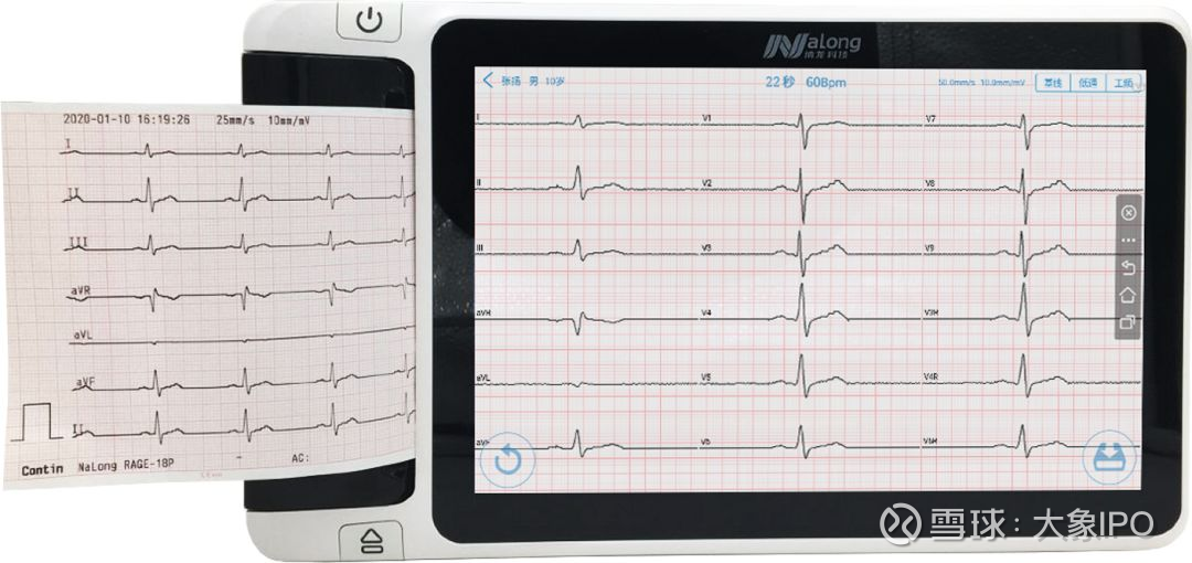 抗击疫情纳龙科技捐赠110套数字化心电图机