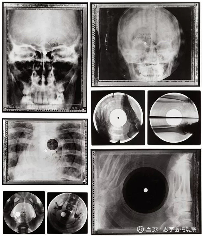 趣闻给你一张x光片做成的唱片你敢听吗