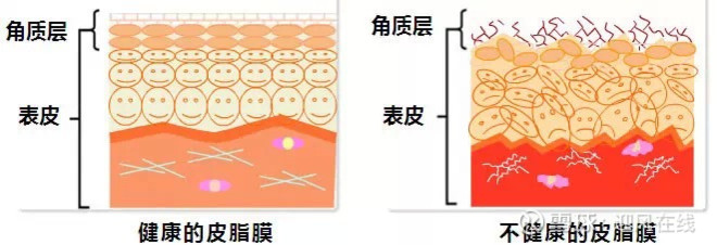 面部皮肤知识皮肤结构篇