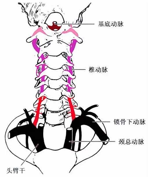 信立泰椎动脉药物洗脱支架获批上市要点再解读