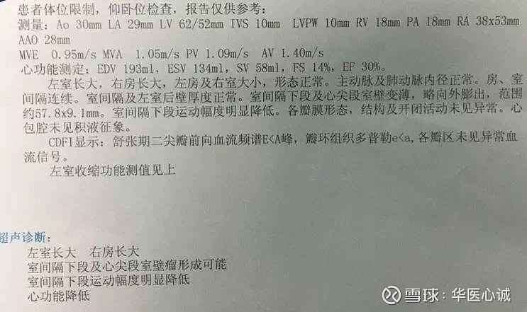 华医心诚医生集团超声心动图十大基本功:报告解读及常见误区下