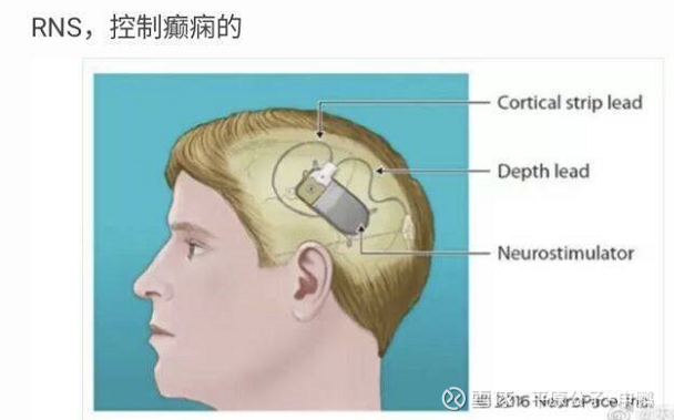 平原公子：懂王生病，不许高兴？