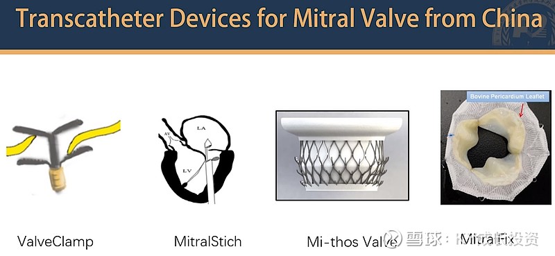 捍宇医疗二尖瓣修复单赛道新星