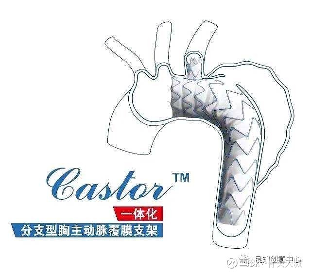 陆清声教授谈castor支架的研发故事