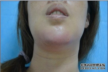 路过十八次: 医学美容之生物补片 就美容几个科