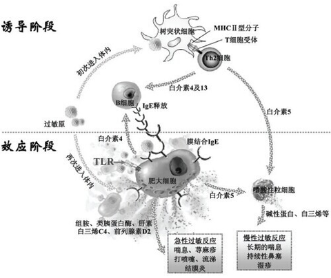 過敏性鼻炎發病機制