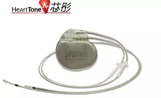 技术开发：引领行业变革的力量