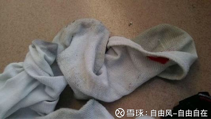 福建漳州男子下班回家后喜欢闻自己臭袜子结果导致肺部真菌感染