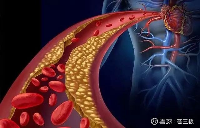 全产业链心脑血管药品供应商——柯菲平 上世纪末,一个有着多年医药销