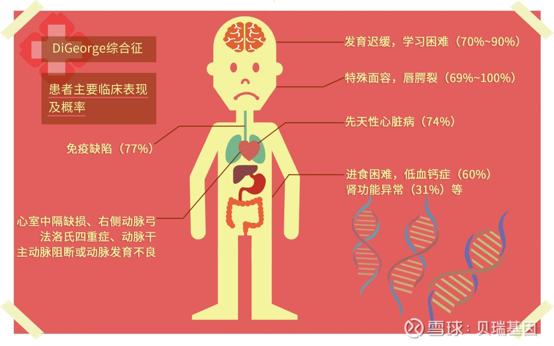 图:digeorge综合征临床表现 这种多数人并不熟悉的疾病却有着不低的