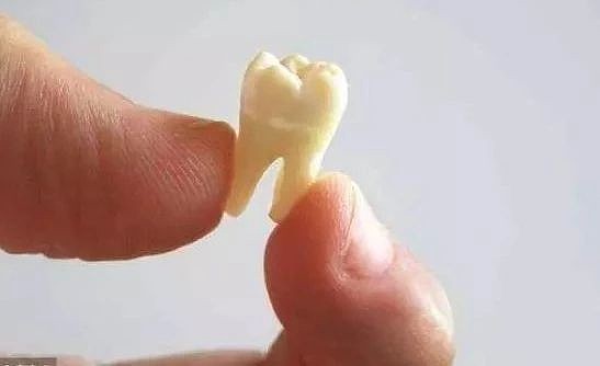 一入"牙门"深似海 还记得我