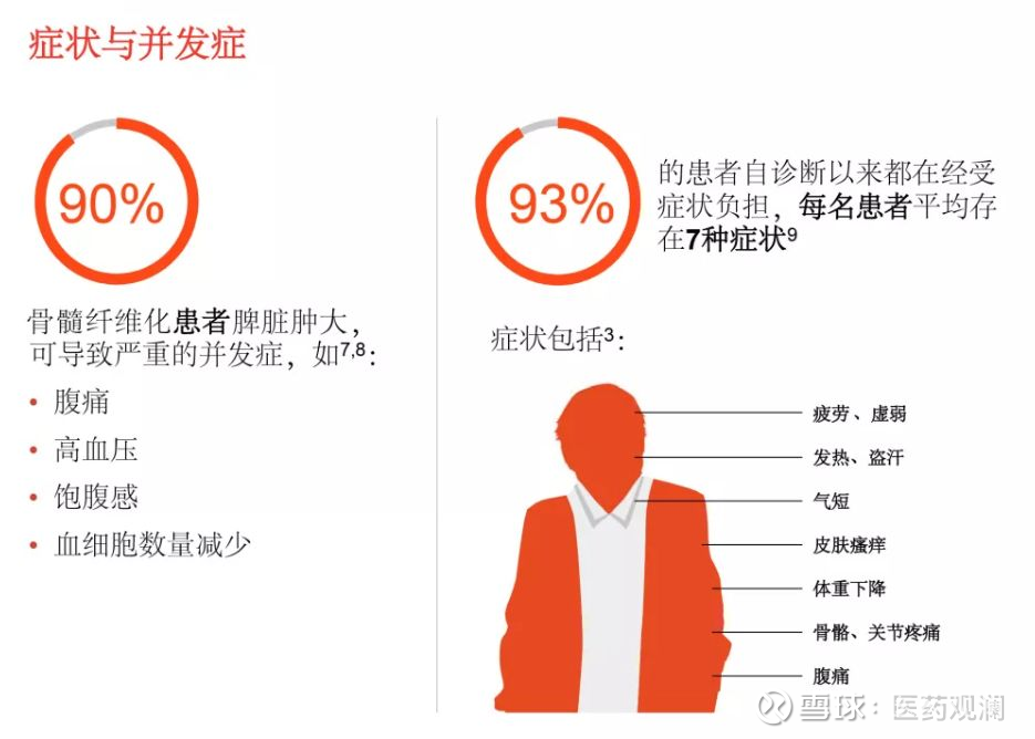 骨髓增殖性疾病 搜狗百科