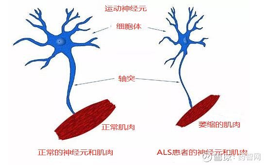 依赖性钠通道的失活状态,干扰神经递质与兴奋性氨基酸受体结合后细