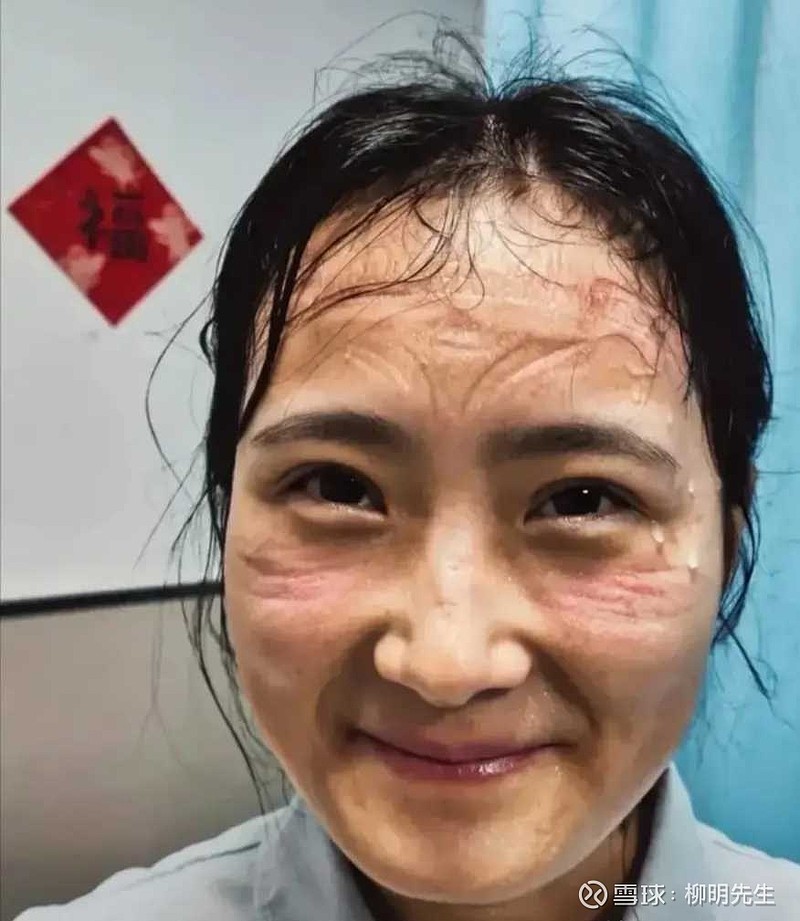 图片来源武汉某医院的白衣天使,脸上都汗水还有脸上的痕红红的,致敬