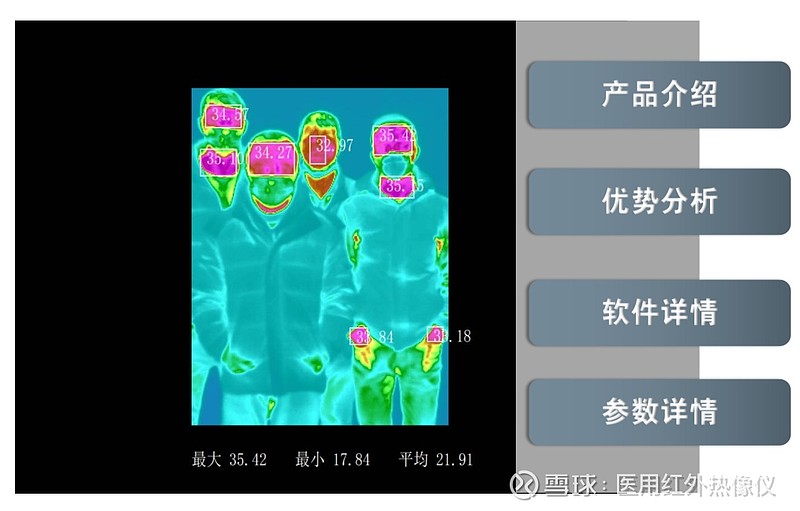 人体亚健康检测仪,健康体检筛查仪 医用红外热像妇女乳腺的应用正常人