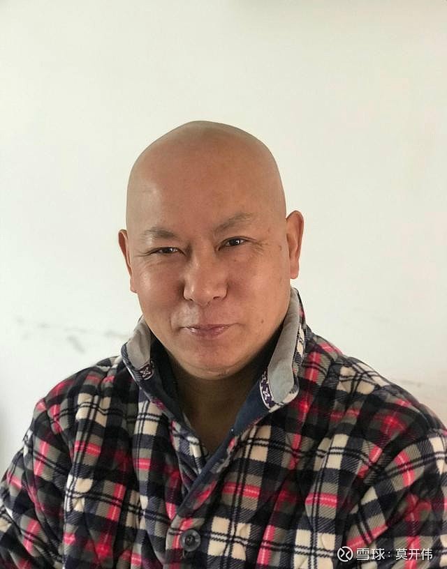 没有办法,只得让妻子用刮胡子的剃刀帮我理了一个大光头,感觉还是差了