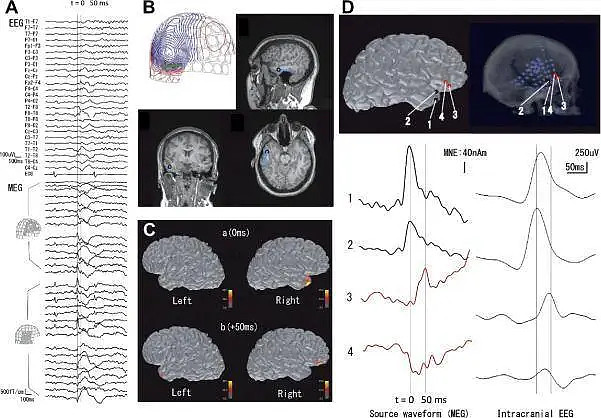 行业脑磁图探索生命禁区的新星