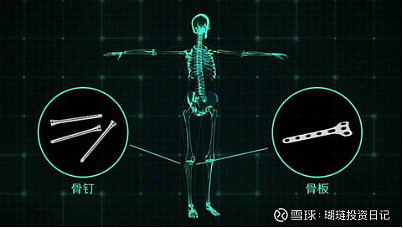 生物可降解醫用鎂骨釘行業宜安科技