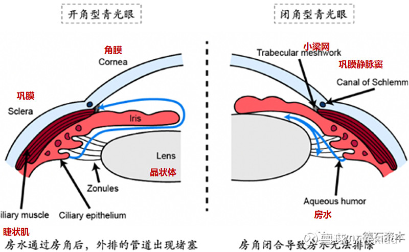 恒瑞连青光眼市场都未放过