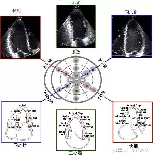 华医心诚超声心动图基本功:心肌分段与心脏切面,冠脉供血的关系