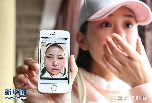 豪门千金韩国整形身亡!医美机构良莠不齐,事故