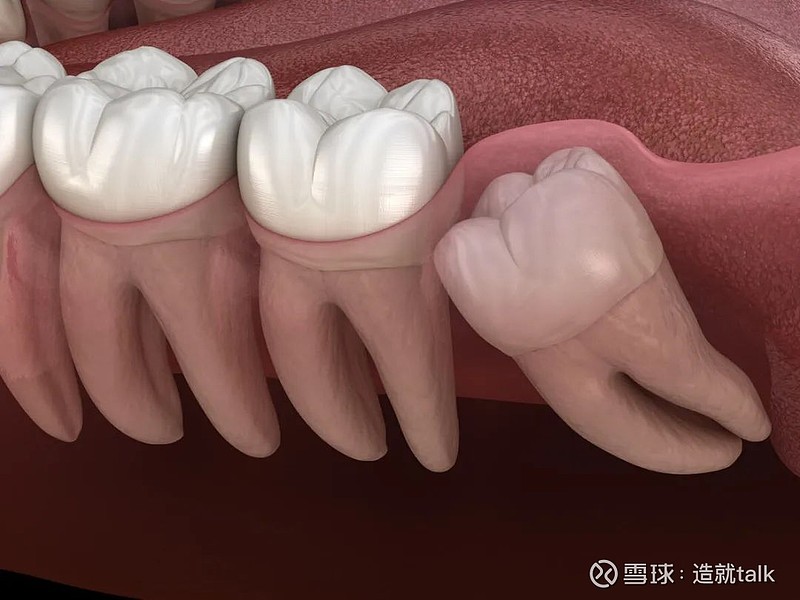 當然,正中動脈不是人類還在進化的唯一例子.還有我們熟悉的 智齒.