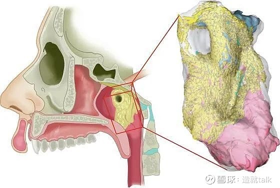 新唾液腺被发现,癌症化疗有福音