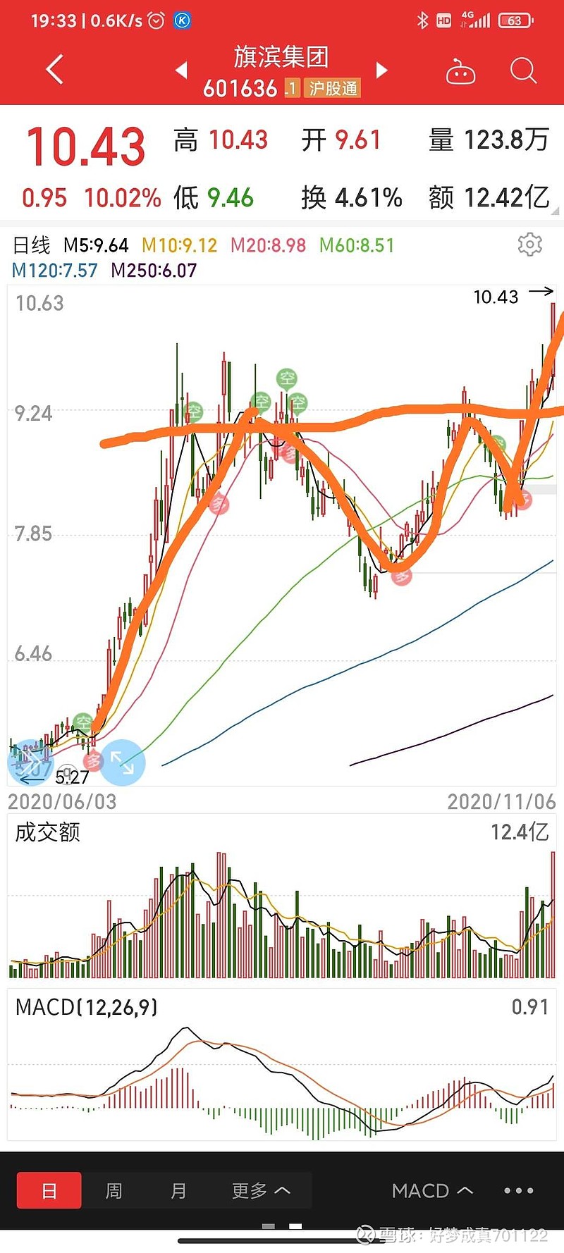 一个VCP形态（2020.11.08）  在医院陪护老父亲。打完针，吃完饭，散完步，吃完药，刮完胡子，洗完脸及脚，扶父亲上床躺下睡觉，这一切安排妥当。姐拿出手机写...