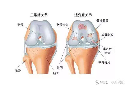 4个动作教你缓解关节炎