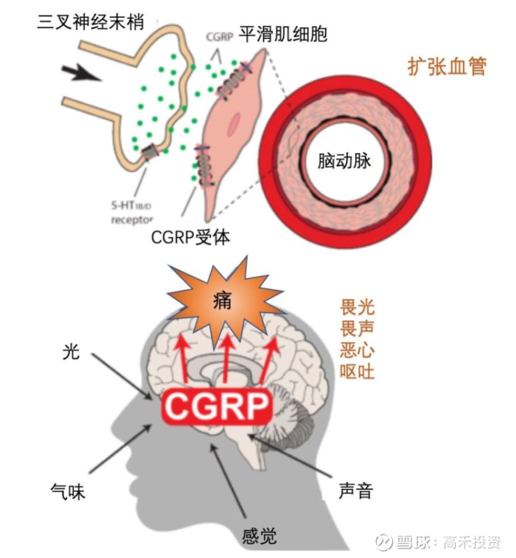 110亿美元 偏头痛药物 市场 6款cgrp新药入局角逐作者 高禾投资研究中心来源 高禾投资 Id Ghicapital 项目征集 高禾投资 将长期坚持以研究为核心驱动