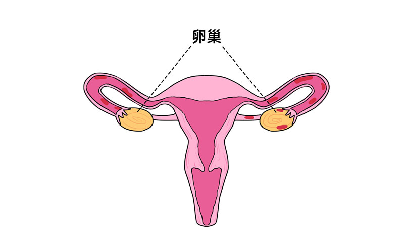 哪些产品投保最宽松?「卵巢囊肿」是怎么回事?