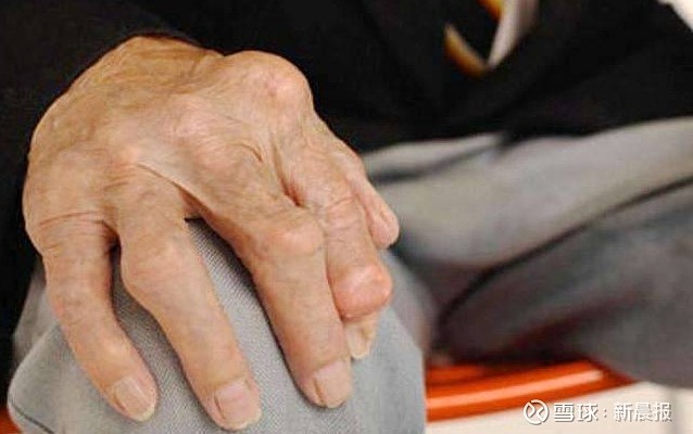 吸收好,见效快,解决筋骨疼痛神器——今尔康冷敷凝胶!