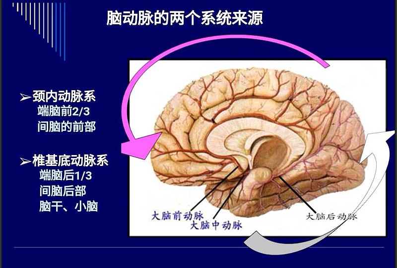 接種腺病毒載體新冠疫苗後出現腦靜脈竇血栓有多麼可怕