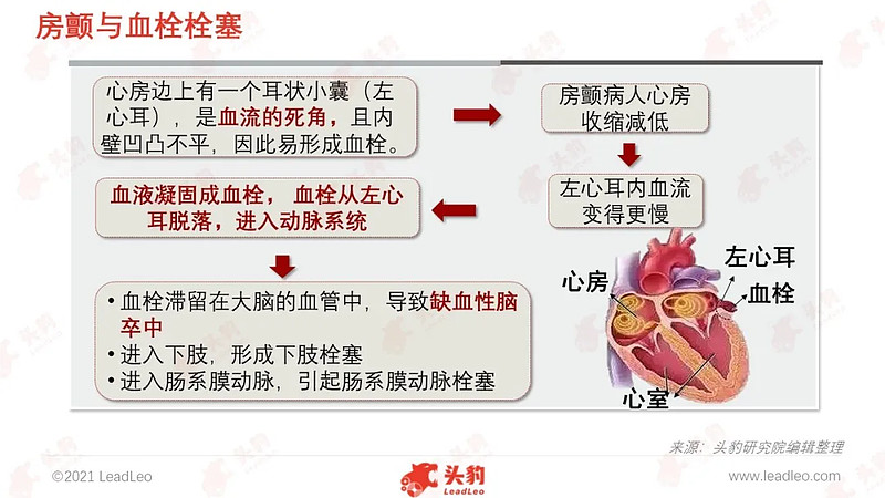 治疗,利用左心耳封堵器来闭合左心耳,预防房颤时在左心耳内血栓的形成