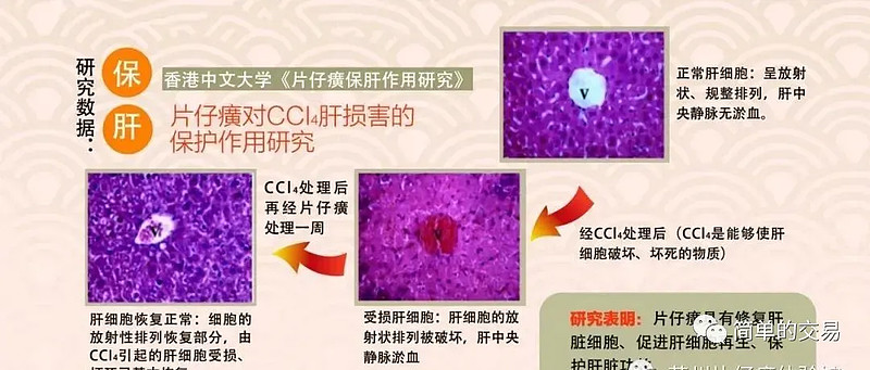 护肝补肝吃什么好_食补护肝应吃哪些_吃食补护肝应吃什么药