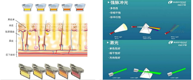 不同的光热作用可治疗不同的皮肤问题,激光比强脉冲光更加聚焦能量