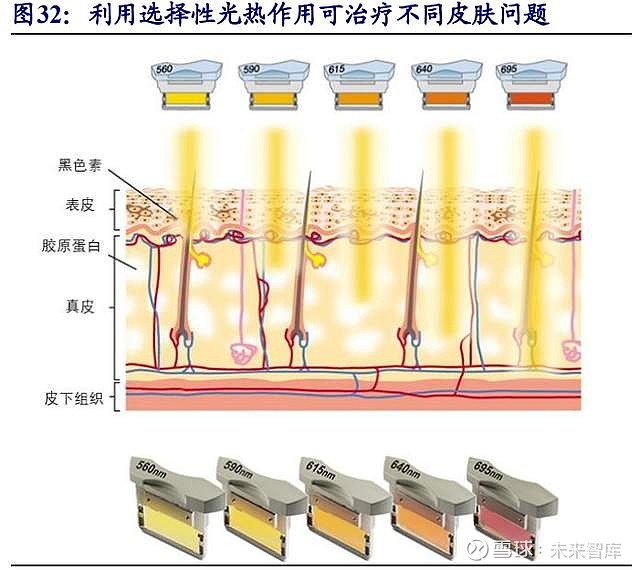 1, 光治疗设备:强脉冲光(光子嫩肤),激光(祛斑祛痘)等根据发射光类型