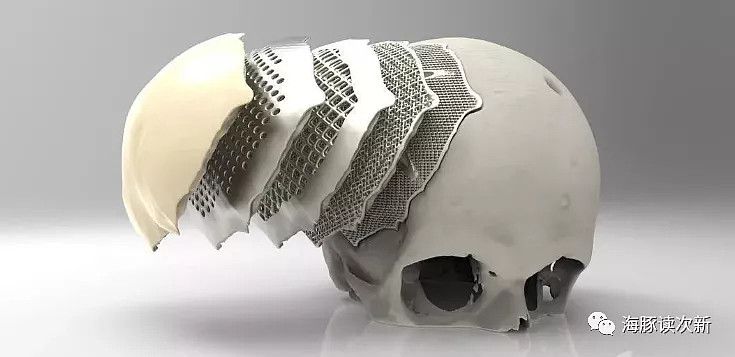 攻入颅腔peek颅骨修补固定医疗器械第一股多产品为国内首个获批一款