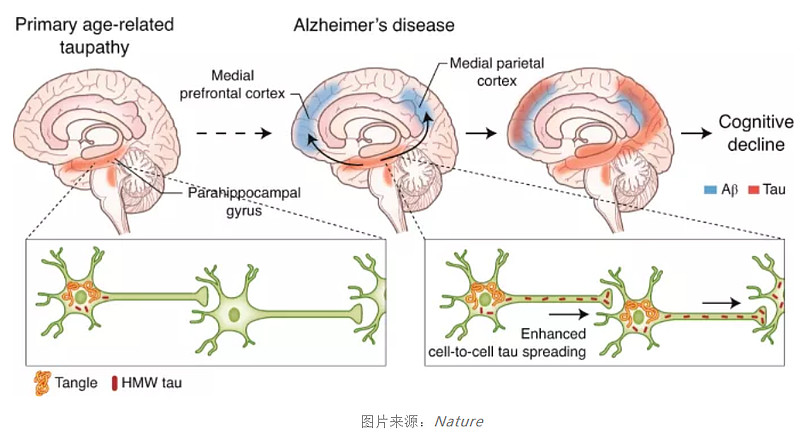 阿尔茨海默病领域风向突变神经领域长跑选手先声药业有了新动作