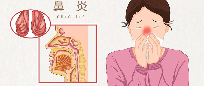 慢性鼻炎居然不能正常买保险?