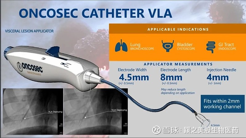 BioNews | OncoSec：联合默克KEYTRUDA®，推进III期TAVO™ 治... 作者：林出 微信公众号：蹊之美股生物医药 ...