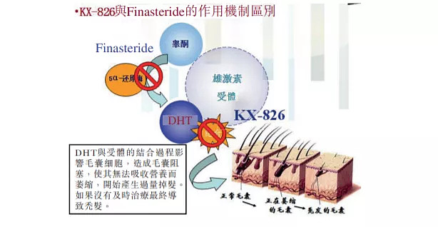 開拓藥業福瑞他恩治療雄激素性脫髮ii期臨床試驗獲fda許可