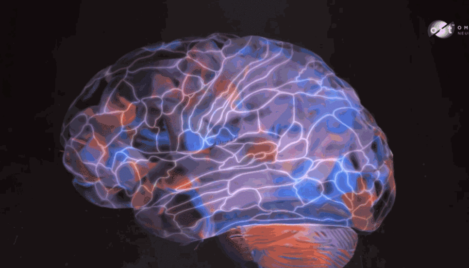 facebook 澳大利亚前 ceo stephen scheeler 解释道,绘制大脑神经元