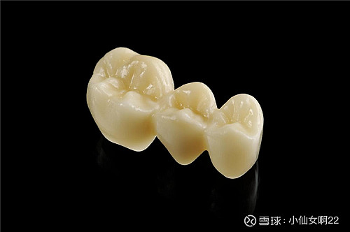 据我从网上查找的资料,加上同事反馈的信息反应,来自德国的瓷睿刻全瓷