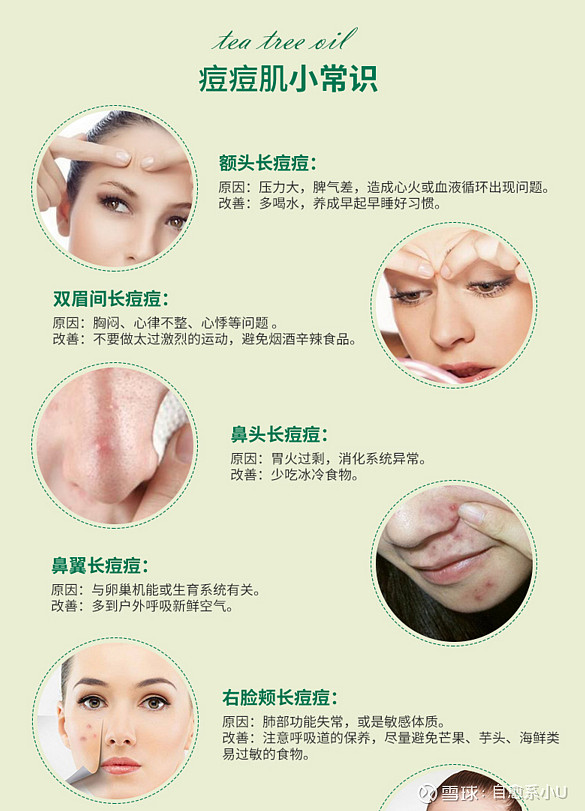 7,胸前及后背:脖子是淋巴的反射区,这个部位长痘代表淋巴循环不畅,与