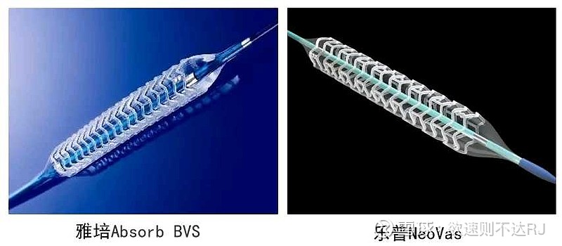 全球首款！全降解铁基冠脉支架系统获准临床试验 $乐普医疗(SZ300003)$ $微创医疗(00853)$ $先健科技(01302)$ 目前 ...