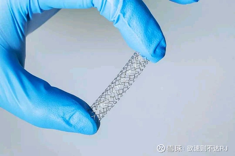 全球首款！全降解铁基冠脉支架系统获准临床试验 $乐普医疗(SZ300003)$ $微创医疗(00853)$ $先健科技(01302)$ 目前 ...