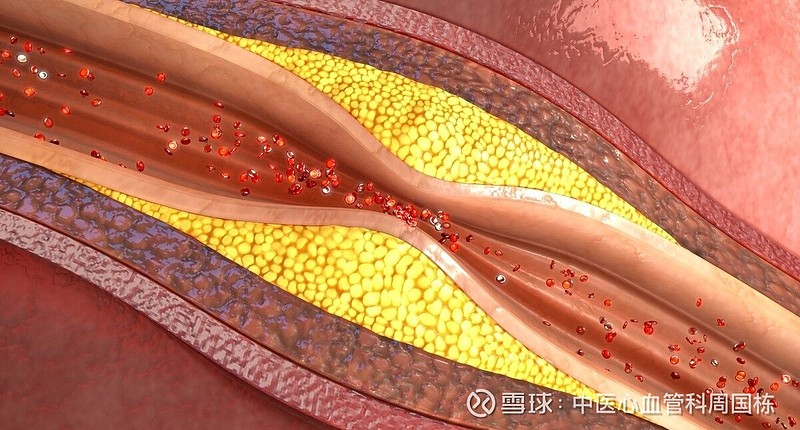 大動脈,易於超聲檢測,所以常被用來作為檢測全身動脈系統的一個